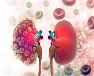 Urology
